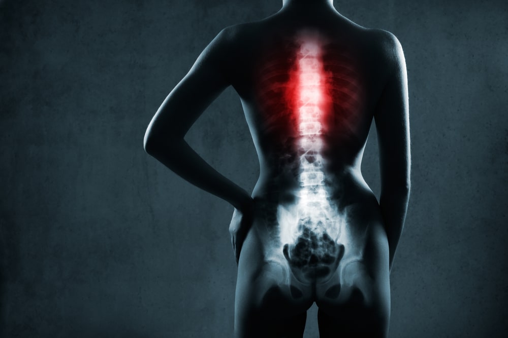 Back and Spinal Cord Injuries from Florida Accidents - Jacobson Injury Firm